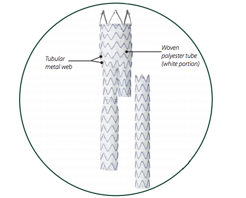 Система доставки стенты. Тефлоновый стент графт. Эндопротез (стент-графт).
